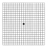 Тест «Сетка Амслера»